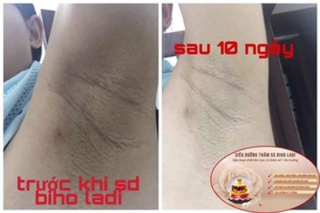 BIHO LADI kem đặc trị thâm hôi (nách, bẹn, Mông, bikini) | BigBuy360 - bigbuy360.vn