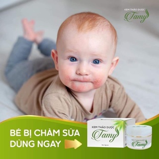 Kem thảo dược Tamy