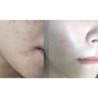 Serum dưỡng senvi