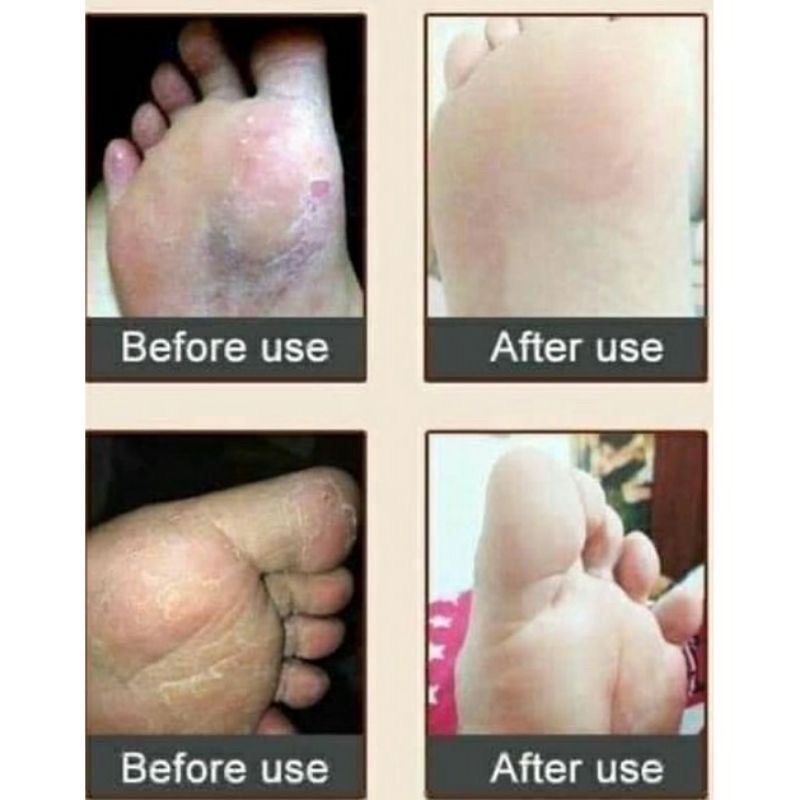 KEM DẦU NGỰA DƯỠNG DA CHÂN lọ 30 gram