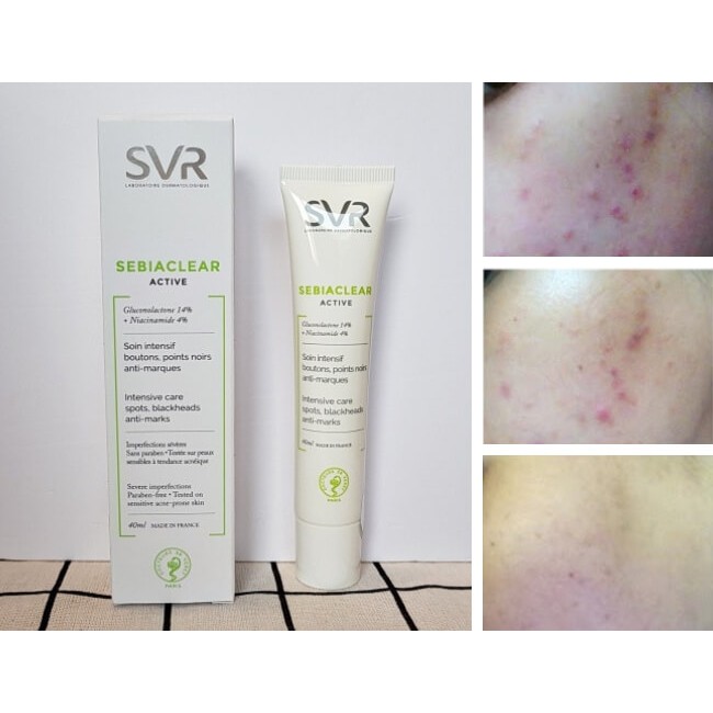 SVR Sebiaclear Active Cream - Kem Dưỡng SVR Active giảm mụn, giảm dầu nhờn cho da 40ml | BigBuy360 - bigbuy360.vn