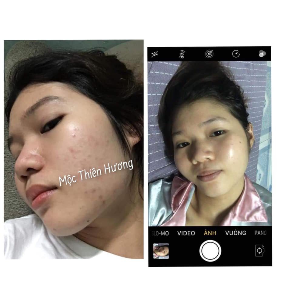 Serum Trắng Da Mờ Mụn Thâm Nám Tàn Nhang 100ml Mộc Thiên Hương | BigBuy360 - bigbuy360.vn