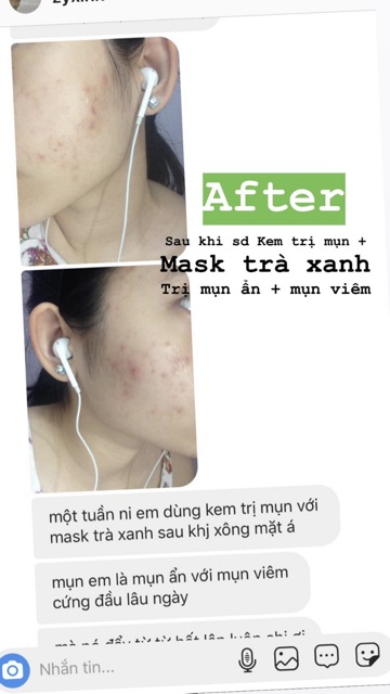  Kem mụn handmade Sunday Beauty | BigBuy360 - bigbuy360.vn