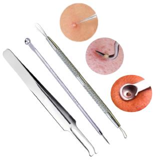 Bộ 3 cây nặn mụn tiện dụng