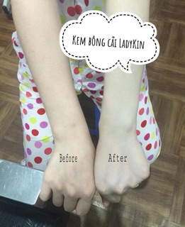 Kem bông cải xanh