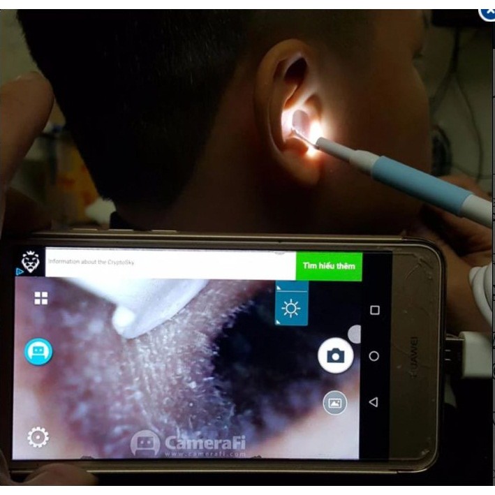 Camera nội soi Tai tặng kèm lấy ráy tai (hỗ trợ smartphone android và máy tính)