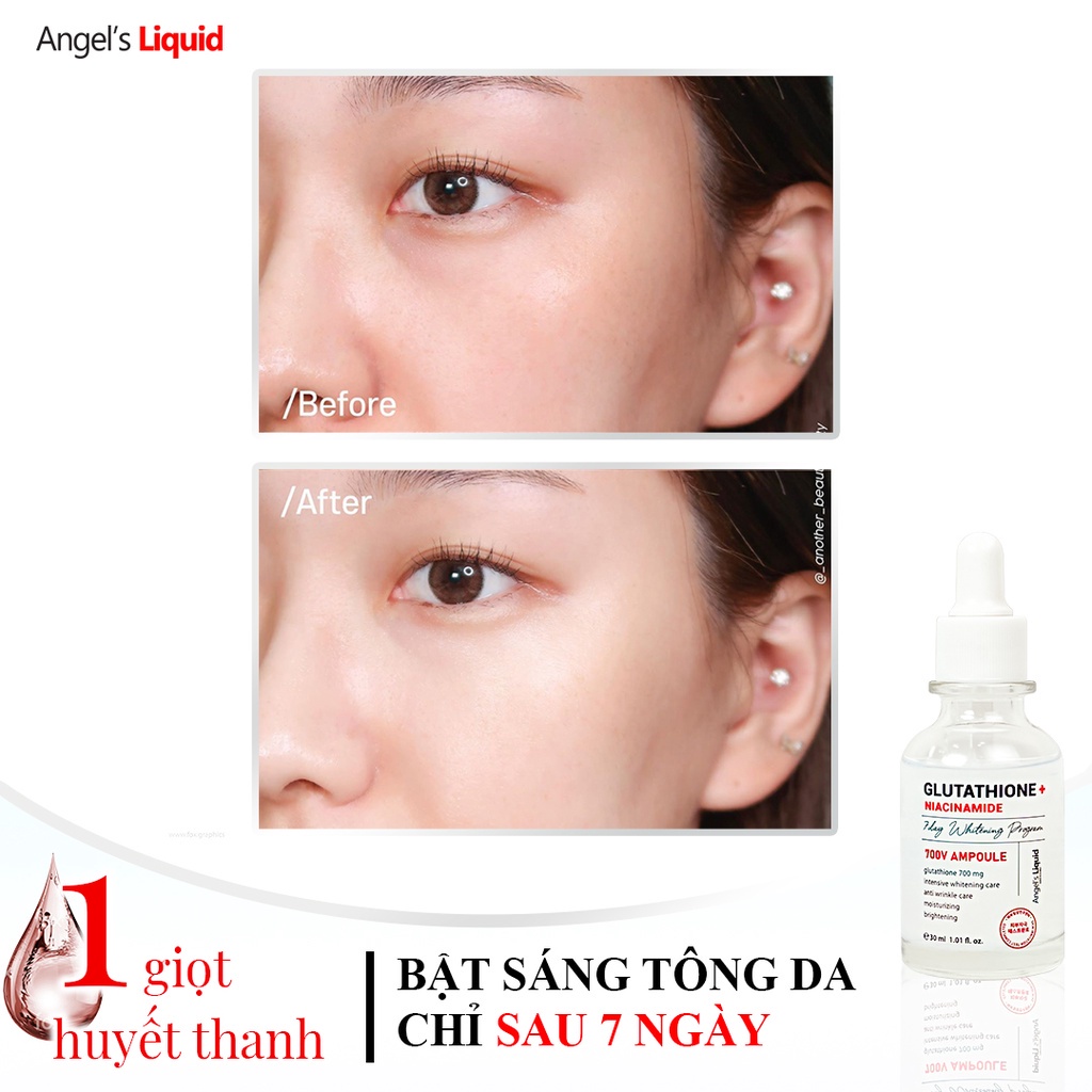Huyết Thanh Dưỡng Trắng Da Mờ Thâm Nám Angel's Liquid Glutathione + Niacinamide 700V Ampoule 30ml