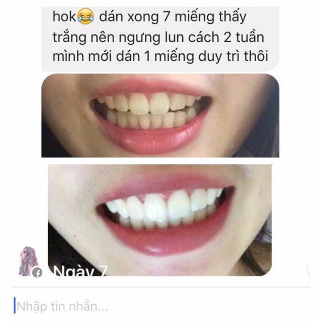 Combo 14 miếng (7 gói/7 ngày) dán trắng răng Crest 3D White Whitestrips loại Professional Effects - Mỹ pzim643s3z