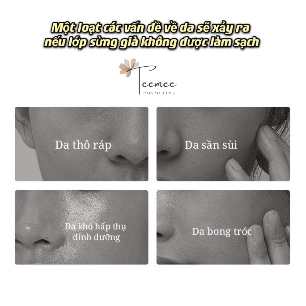 Gel tẩy da chết, gel tẩy tế bào chết Lucenbase Lactobionic Acid 150g hoa cúc, làm sạch sâu, giúp da thoáng mát | BigBuy360 - bigbuy360.vn