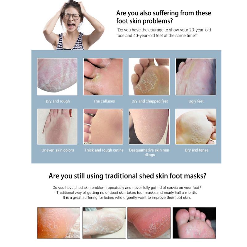 Mặt nạ bàn chân LANBENA dạng lột tẩy tế bào chết dưỡng ẩm và làm mềm da 40g