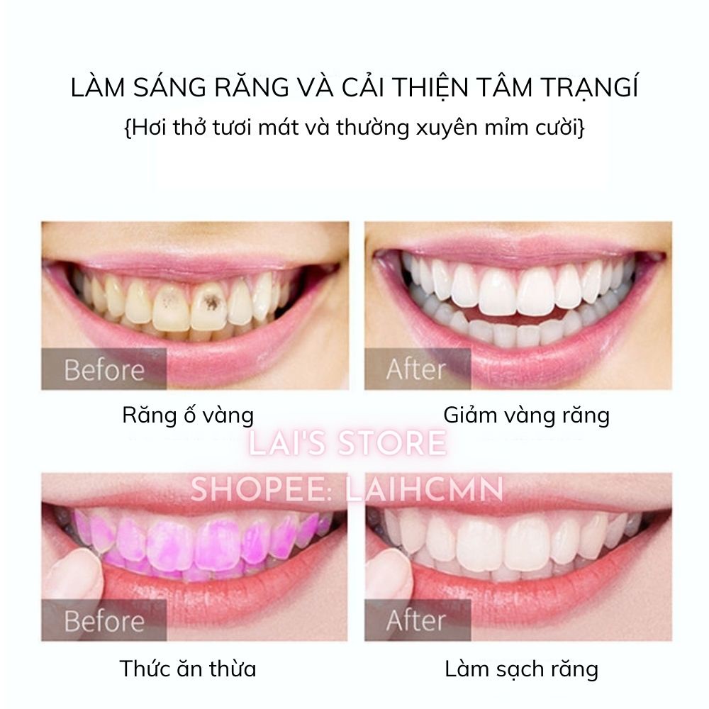 Hộp 20 Gói Nước Súc Miệng Ginbi Hương Trái Cây Không Chất Bảo Quản Giúp Hơi Thở Thơm Mát Giảm Vết Ố Vàng Bảo Vệ Răng