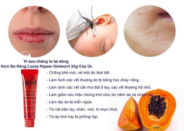 Tuýp Lucas dưỡng môi thần thánh Úc 💄💋