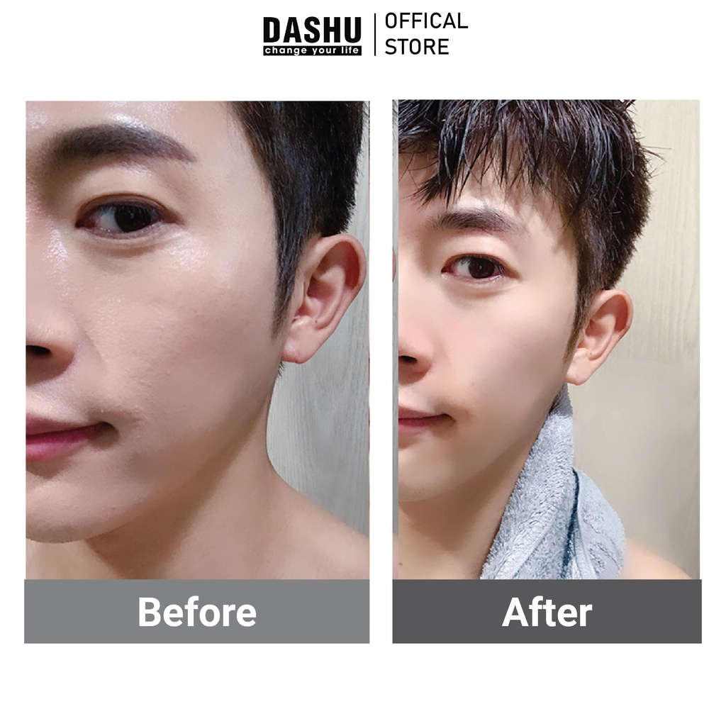 Sữa rửa mặt nam sạch sâu kiểm soát nhờn dành cho mọi loại da DASHU Aqua Deep Seawater