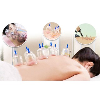 Bộ Giác Hơi 12 Ống Không Dùng Lửa