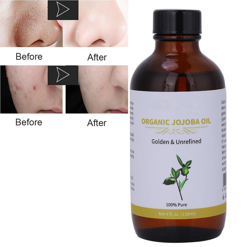 (Hàng Mới Về) Tinh Dầu Jojoba Hữu Cơ Tự Nhiên Dưỡng Ẩm Chăm Sóc Tóc