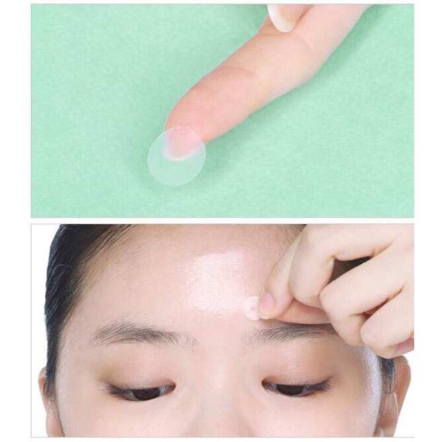 Miếng Dán Mụn Acnes Clear Patch (24 Miếng)