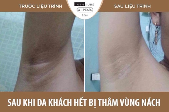 SERUM JIUHE THANH TÔ PHIÊN BẢN MỚI 2021