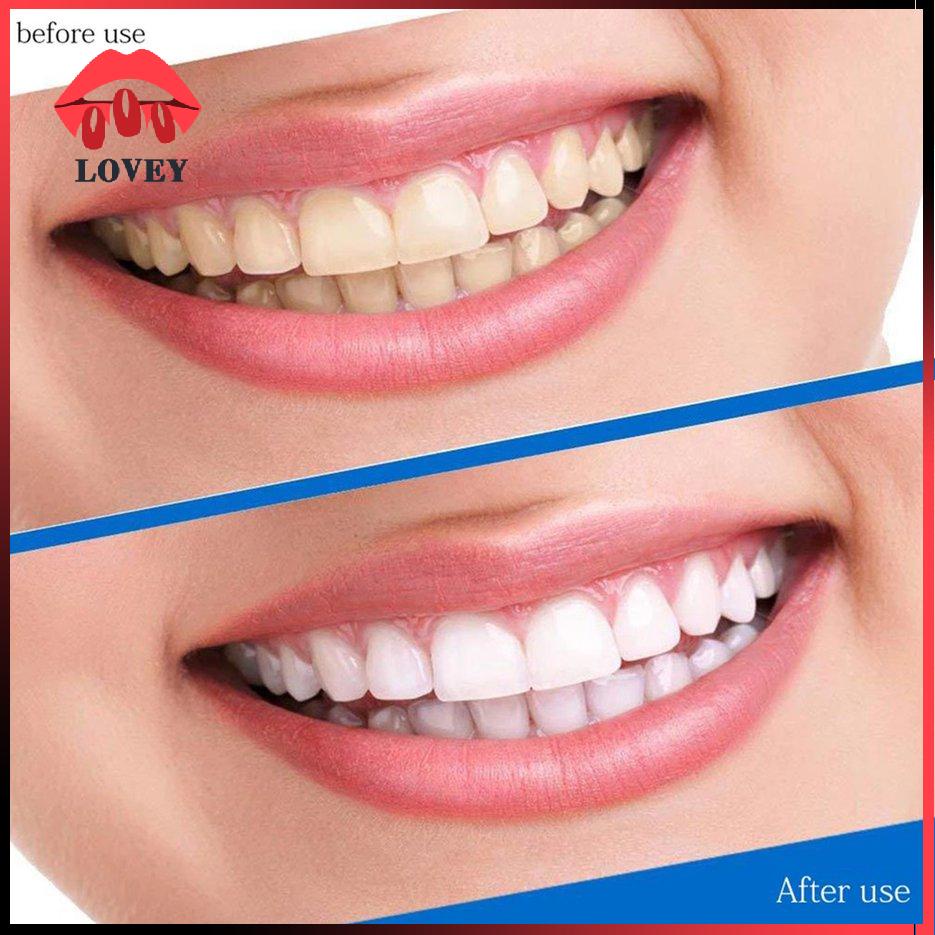 [Hàng mới về] 14 Cặp miếng dán làm trắng răng 5D thiết kế dễ mang theo tiện dụng