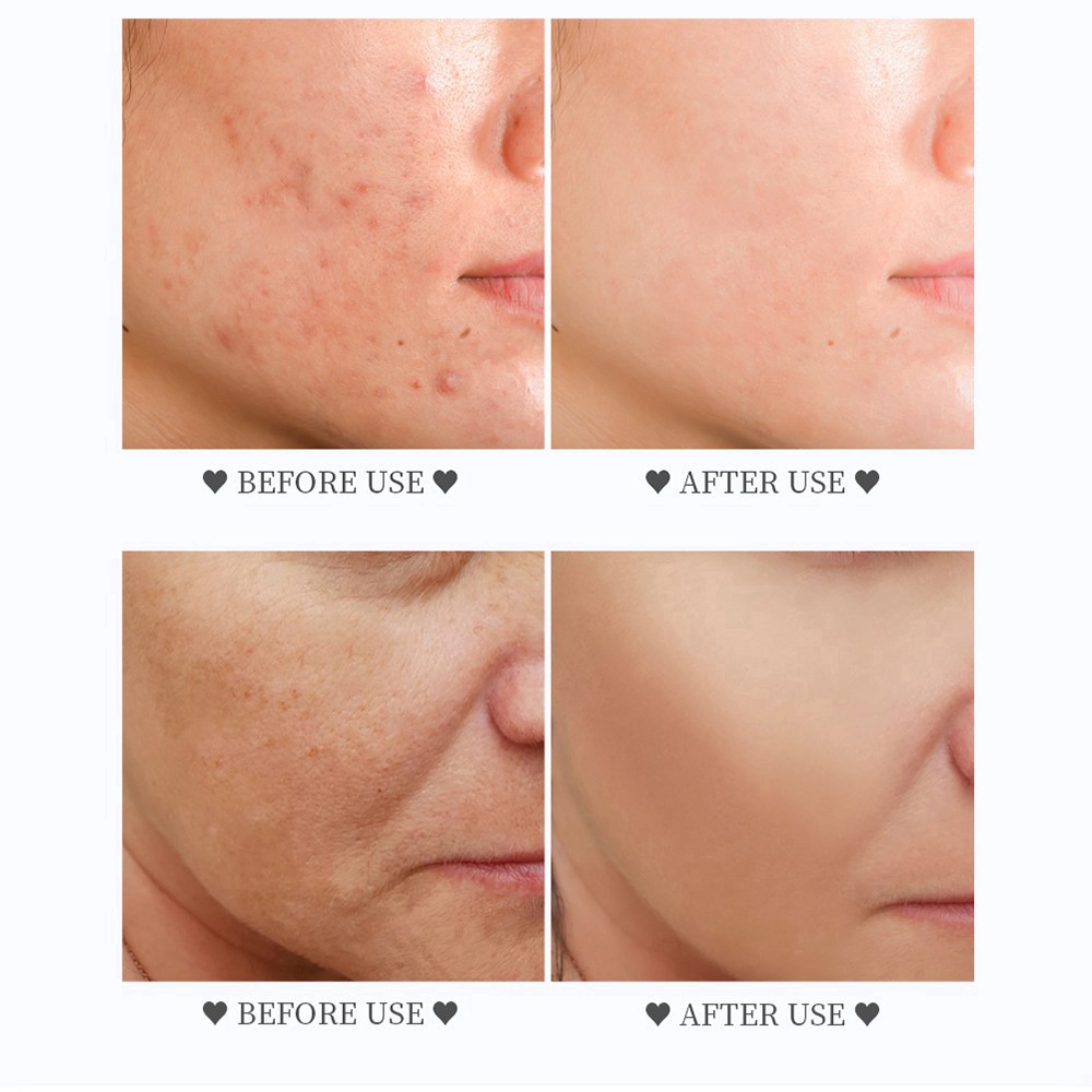 Mặt Nạ VIBRANT GLAMOUR Chiết Xuất Axit Hyaluronic Thu Nhỏ Lỗ Chân Lông Làm Trắng Và Săn Chắc Da Giữ Ẩm Chống Lão Hóa | BigBuy360 - bigbuy360.vn