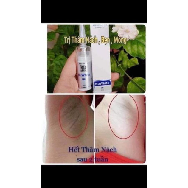Tinh chất Nuwhite H6 mờ thâm nách, bẹn, mông | BigBuy360 - bigbuy360.vn