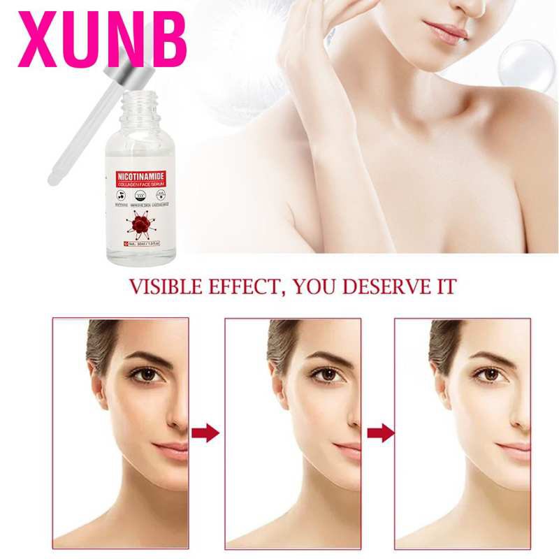 (Hàng Mới Về) Tinh Chất Dưỡng Ẩm Giảm Nếp Nhăn Làm Sáng Da Mặt 30ml