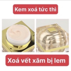 Xóa xăm tức thời thần thánh [ Đảm bảo hiệu quả 100%  ]