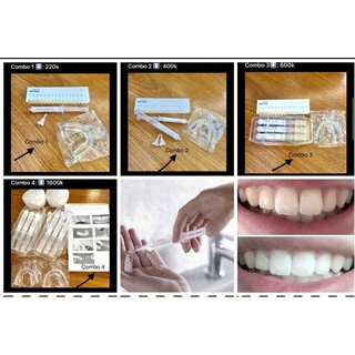 Combo tẩy trăng răng tại nhà #220k ~ 600k