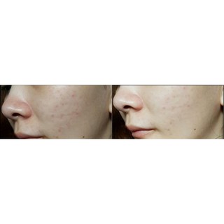 Fullsize - Nước thần Estee Lauder Micro Essence căng bóng da 150ML