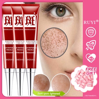 Kem hỗ trợ giảm tàn nhang làm trắng da loại bỏ các đốm đen melanin m2 a25