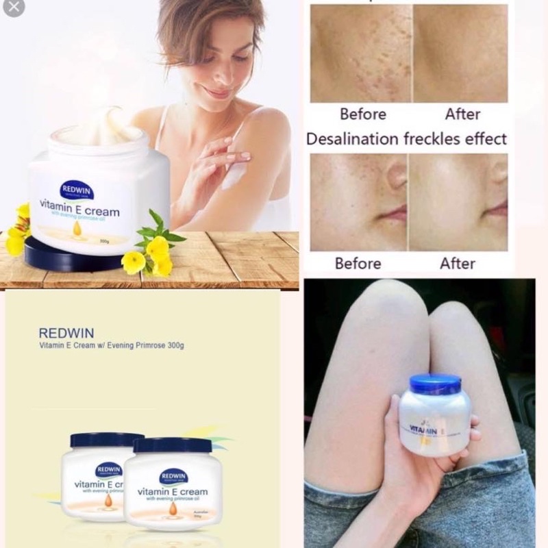 Kem Dưỡng Da Mềm Mịn REDWIN Vitamin E Cream 300gr