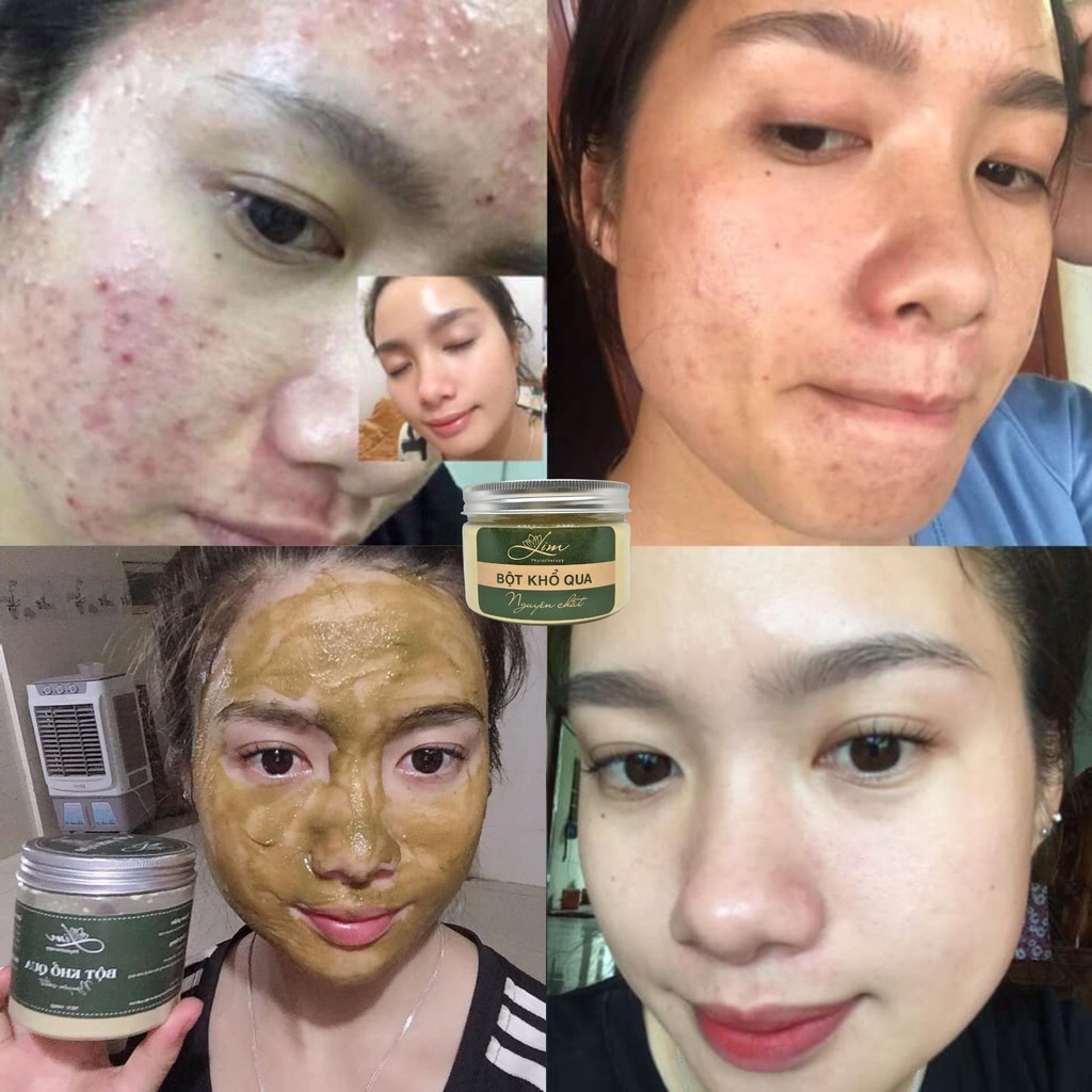 Mask Mặt Nạ Khổ Qua Rừng LimFarm 100g Giảm Mụn Mờ Thâm Da Dầu , Dưỡng Da Căng Bóng , Bột Khổ Qua Rừng - Handmade