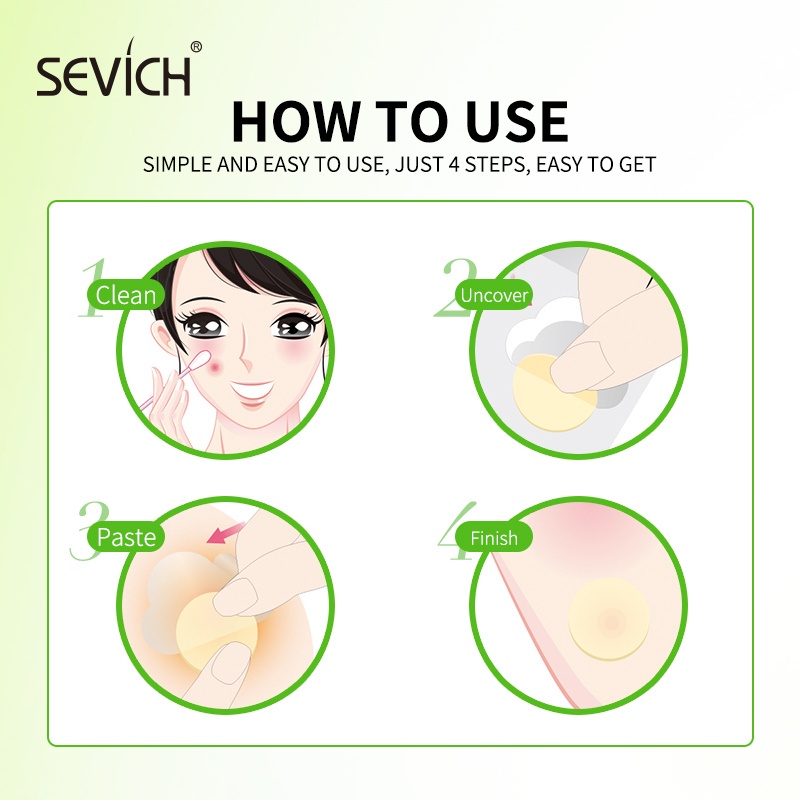 Set 25 miếng dán_mụn Sevich tinh chất tràm trà cải thiện_mụn hiệu quả nhanh chóng- Hanayuki Asia