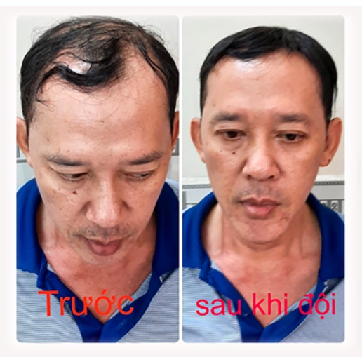 Tóc Giả Ngắn Dành Cho Nam - Chất lượng số 1
