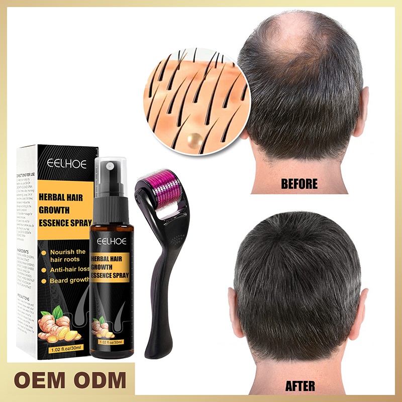 eelhoe hair growth care to promote hair growth roller depxinh