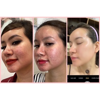 Serum Retinol Huyền Cò