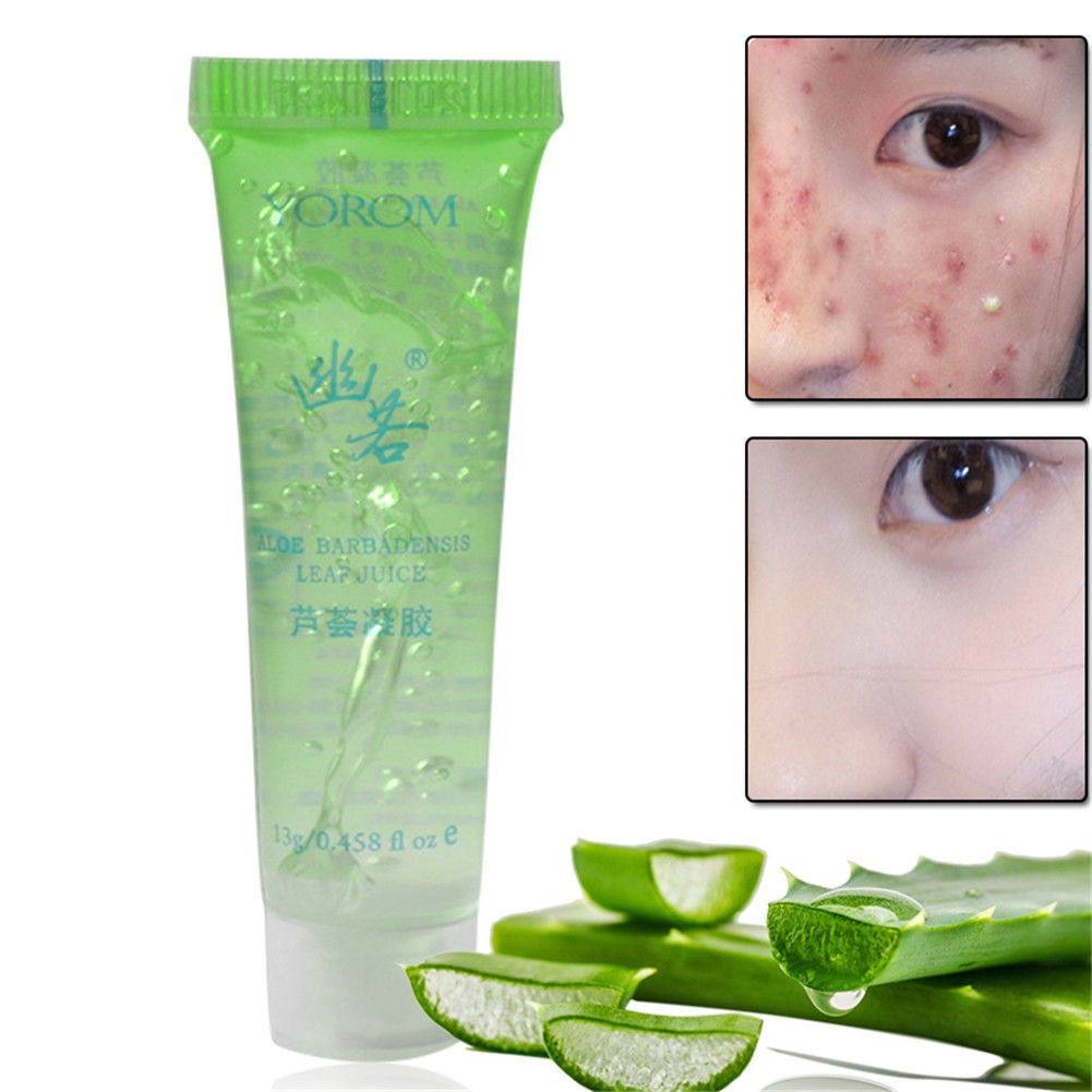 Gel hỗ trợ giảm mụn dưỡng ẩm chăm sóc da chiết xuất lô hội tự nhiên hiệu quả cao