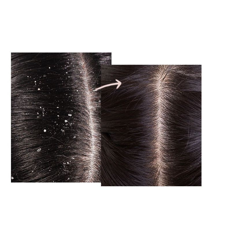 Hũ TẨY TẾ BÀO CHẾT CHO TÓC CỦA HÃNG JIORNIEE