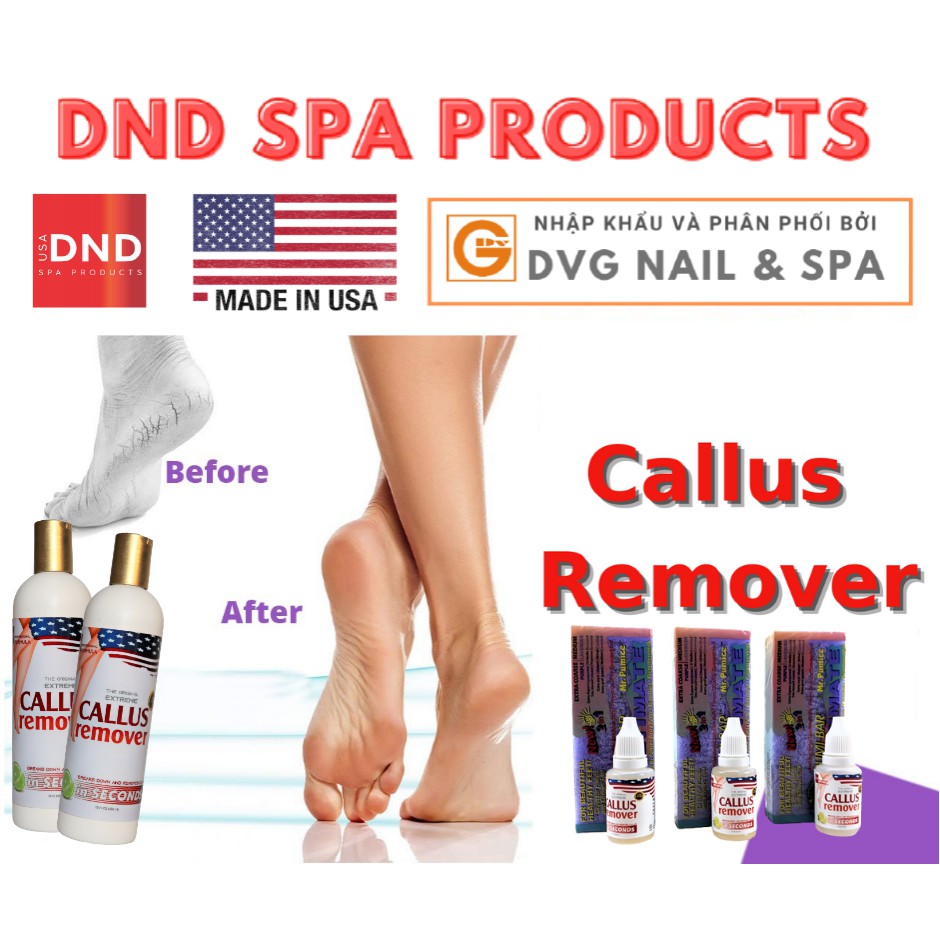 GEL Ủ CHÀ GÓT CHÂN CHO THỢ CHUYÊN NGHIỆP DND CALLUS REMOVER 355ML