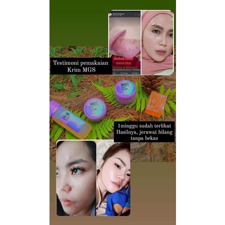 Kem MGS dưới nước | BigBuy360 - bigbuy360.vn