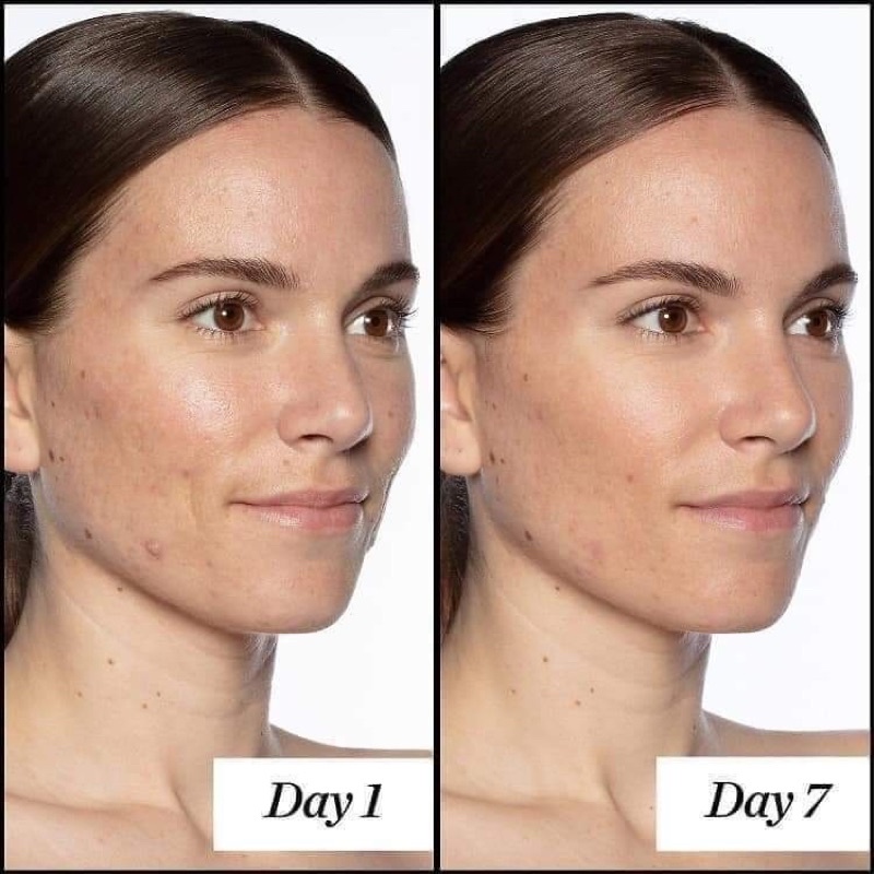 Tinh chất retinol ngăn ngừa lão hóa Sunday Riley A+ High-Dose Retinoid