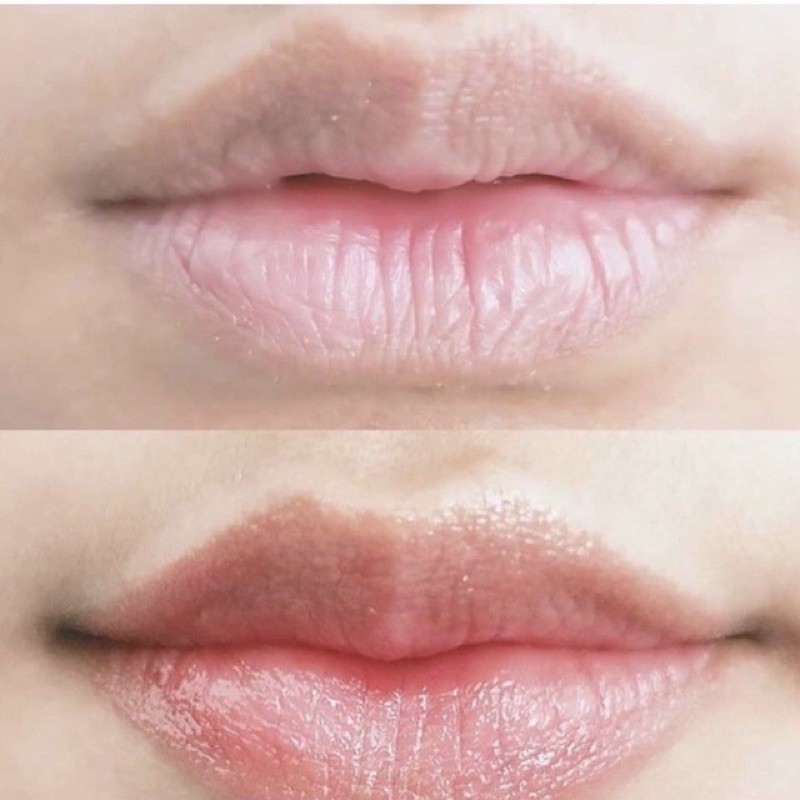 (Hàng Mới Về) Serum Dưỡng Môi Noera Vita Làm Sáng Da Tự Nhiên | BigBuy360 - bigbuy360.vn