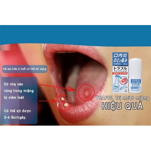 Xịt nhiệt lở miệng TRAFUL 20ml [NỘI ĐỊA NHẬT]