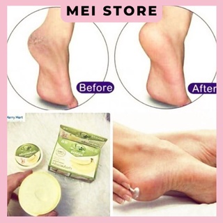Kem Nứt Gót Làm Mềm Chân Thái