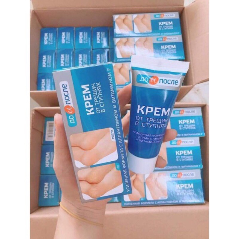 Kem nứt gót chân Kpem Apteka Nga giúp dưỡng ẩm, làm mềm da chân 50ml