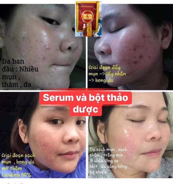 Serum Kiều beautyqueen_date mới 2020