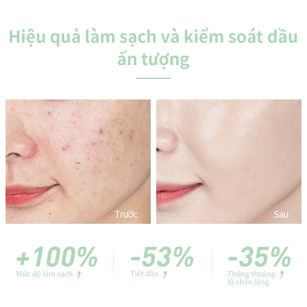 Set 2 Sữa Rửa Mặt Tạo Bọt Trong Suốt Giảm Sưng Đỏ Kiểm Soát Dầu Làm Sạch Sâu Thu Nhỏ Lỗ Chân Lông Lanbena