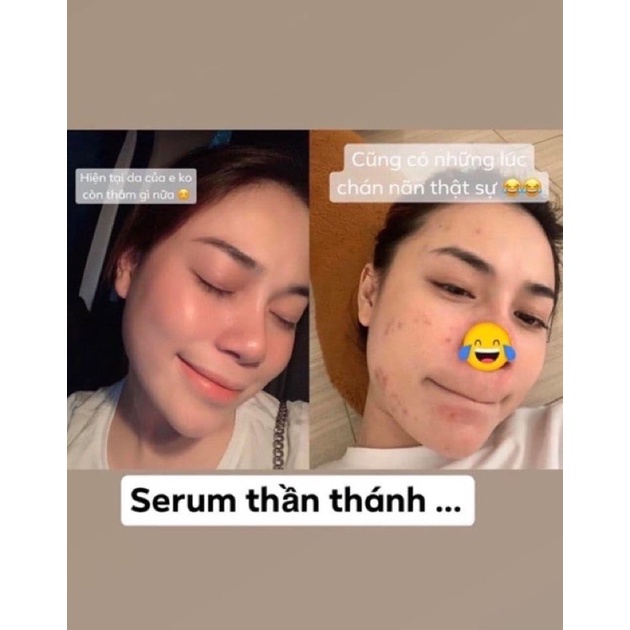 Serum Caramel Nhật Bản ( Check cod phiên bản mới ) | BigBuy360 - bigbuy360.vn