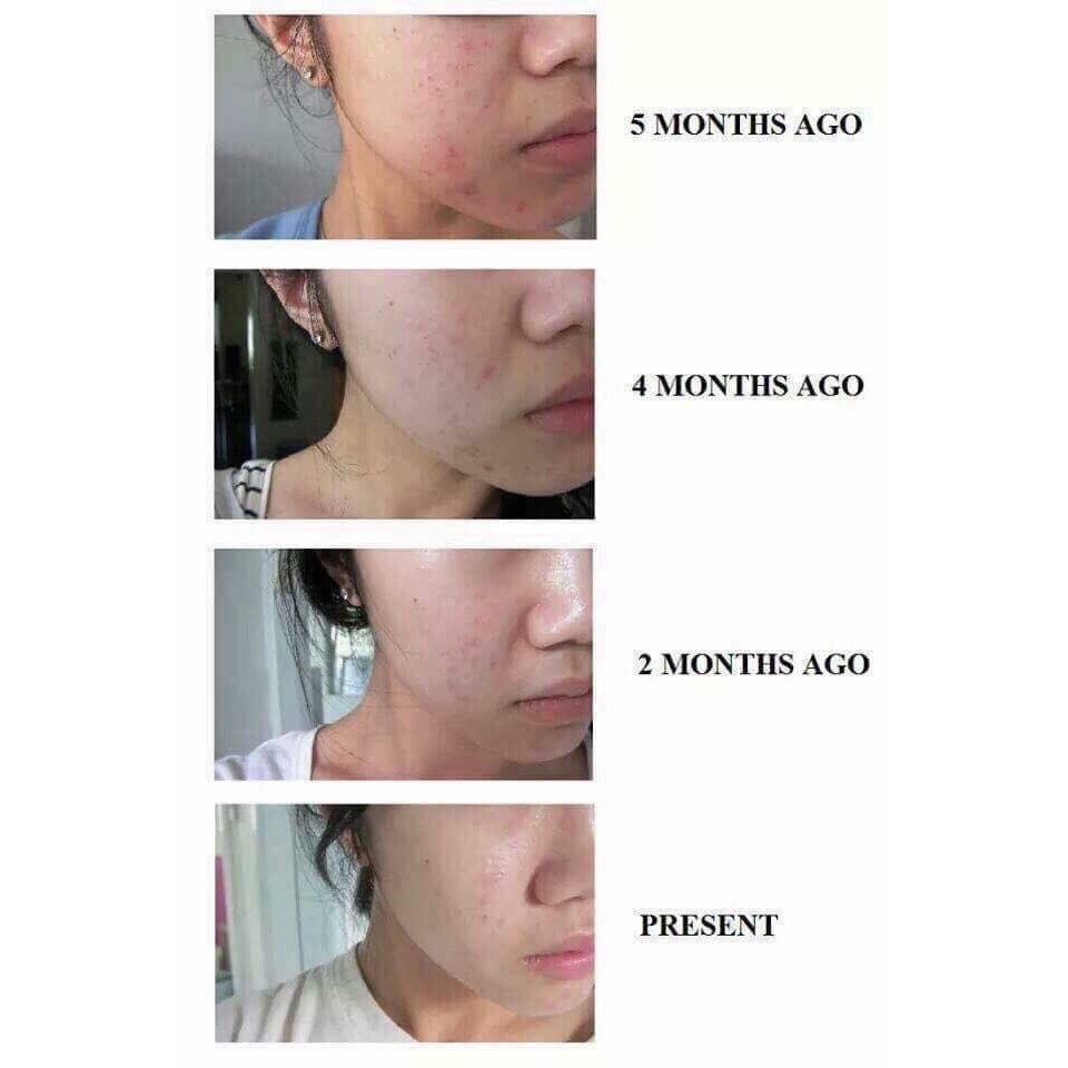 SỮA RỬA MẶT CHO DAMỤN #LA_ROCHE-POSAY EFFACLAR #400ml