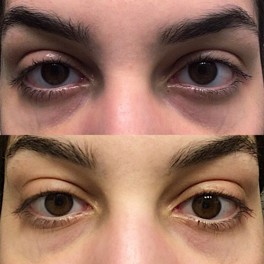 Serum giảm quầng thâm và bọng mắt The Ordinary Caffein Solution 5% + EGCG 30ml