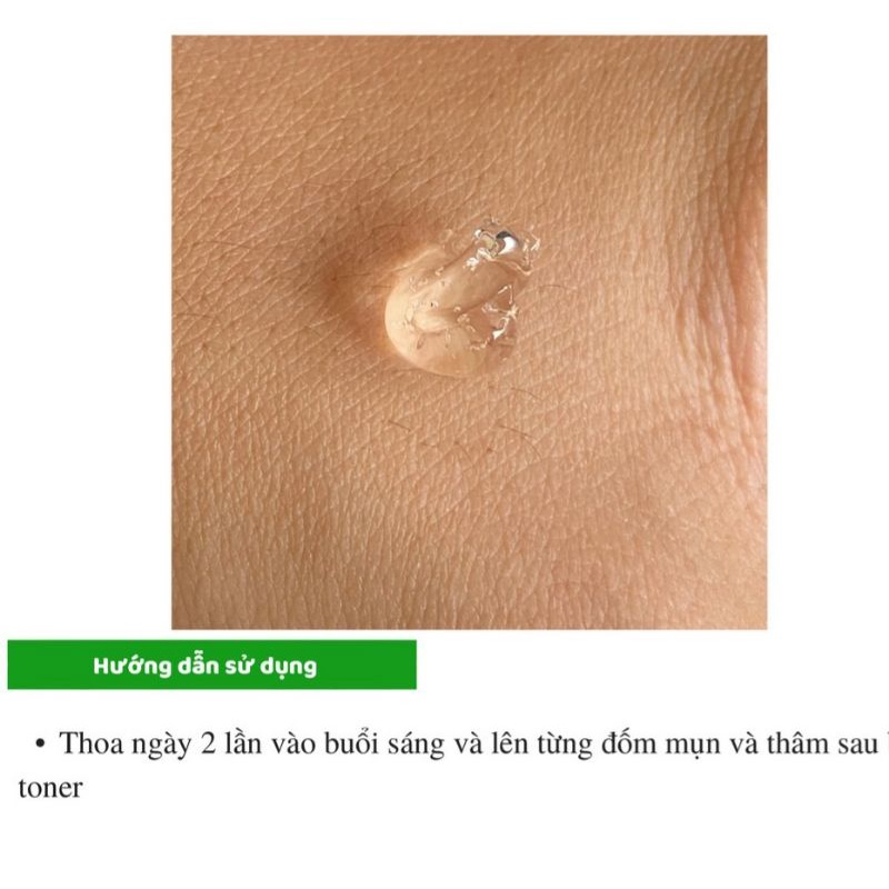 MEGADUO Gel 15g - Bản Thường AHA và Plus Retinal 1.0  - Gel dưỡng giảm mun, vết thâm